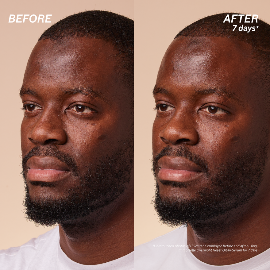 view 9/10 of Immortelle Overnight Reset Oil-in-Serum Refill, , USRECT